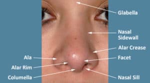 The frontal view of the nose is much more complicated and difficult to see the changes for a rhinoplasty. 